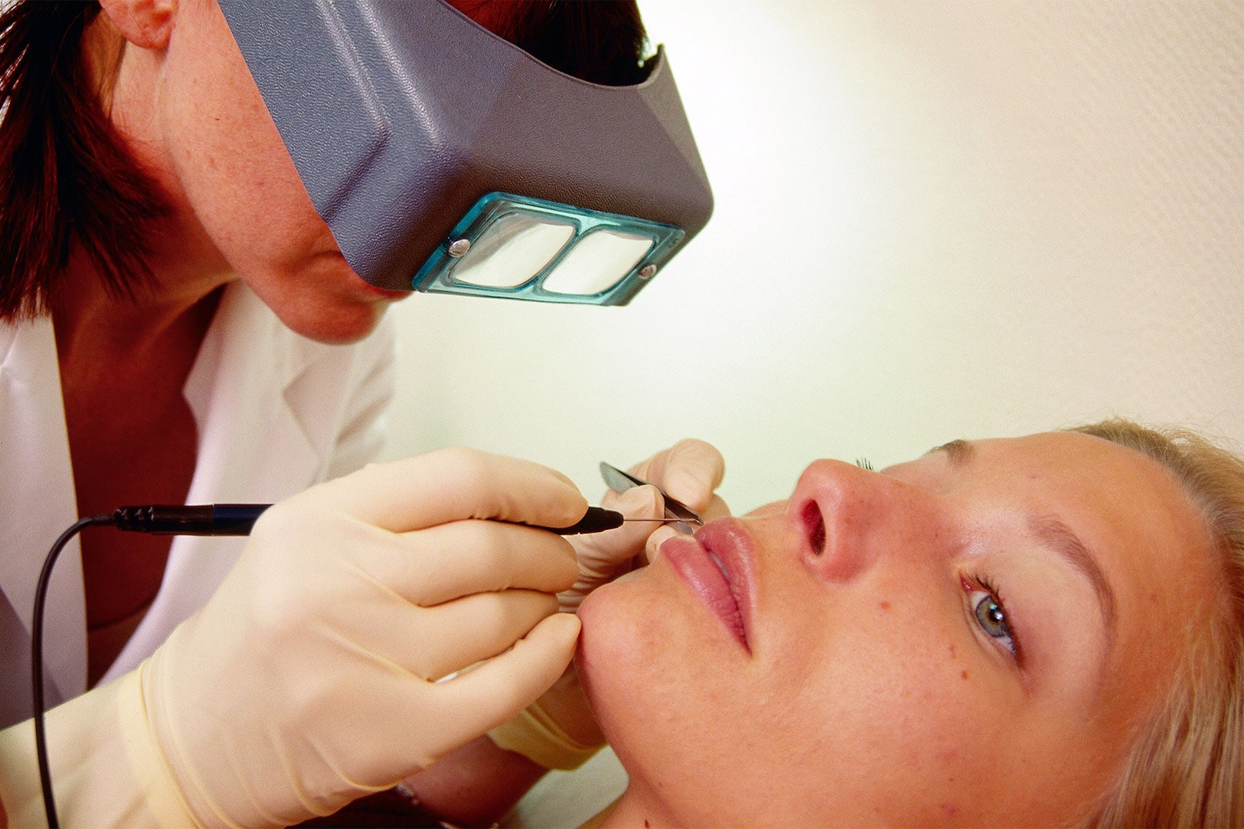 advanced facials in etobicoke