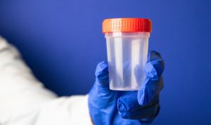 Tips and Tricks for a Foolproof Synthetic Urine Test